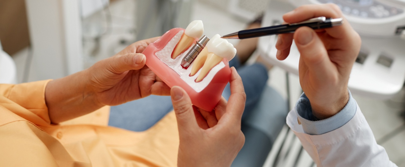 Dental Implant Solutions in Coralville, IA