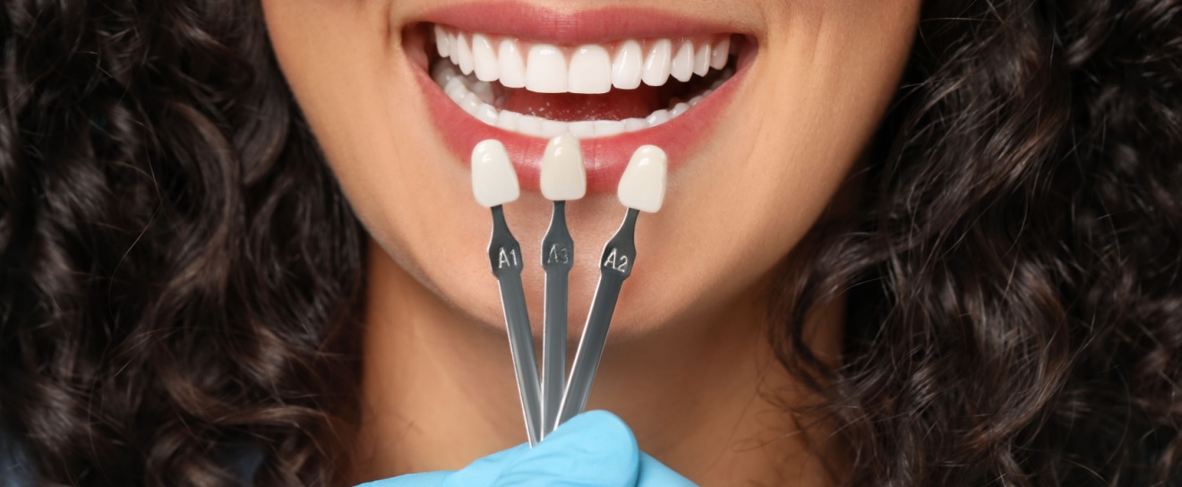 Is Cosmetic Dentistry Covered By Insurance?