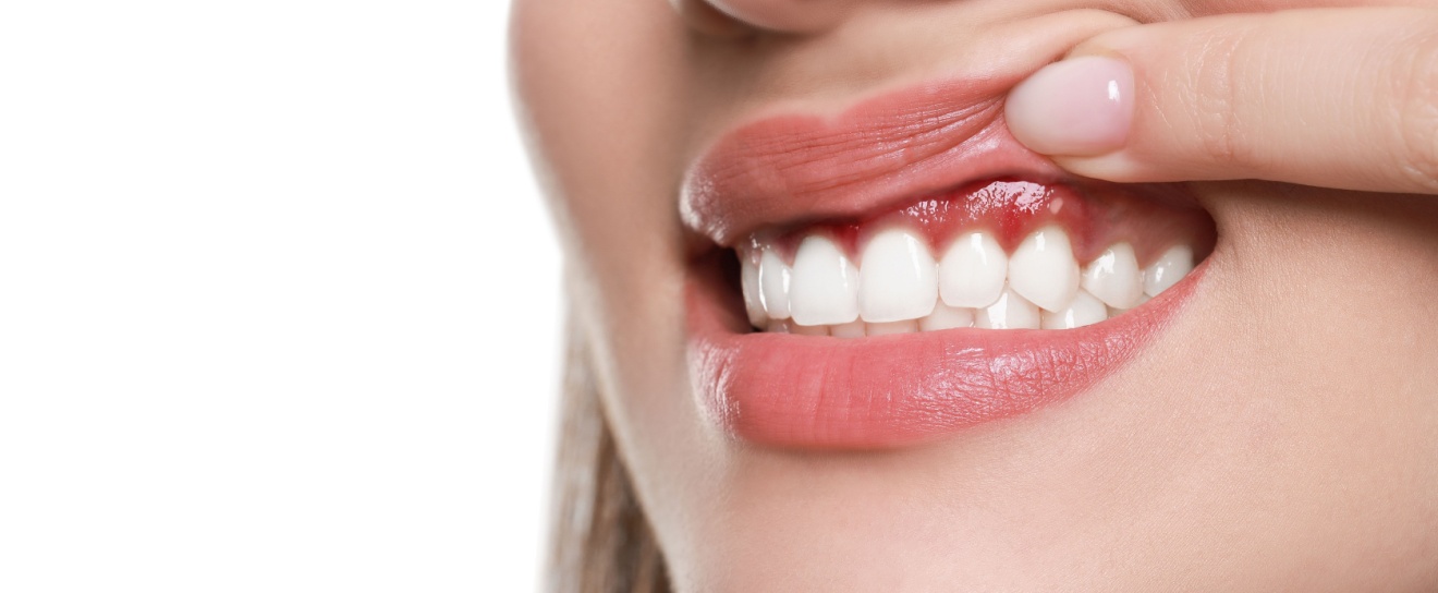 Can I Prevent Gum Disease from Developing?