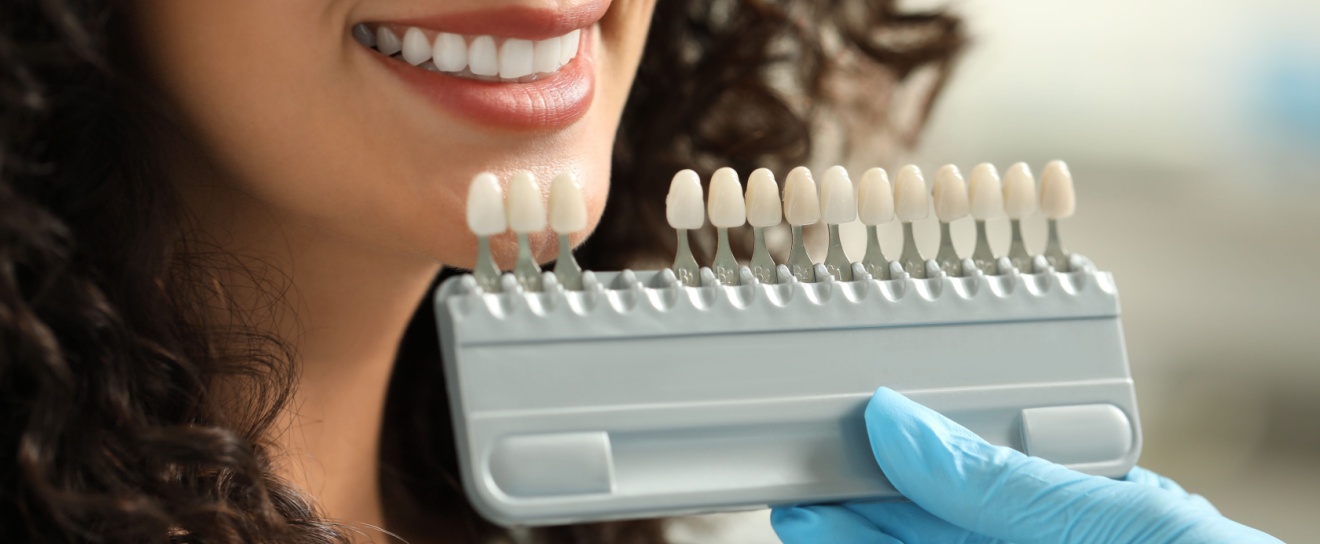 Should I Invest in a Cosmetic Dentistry Procedure?
