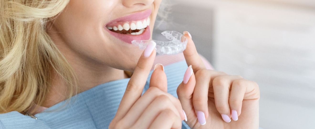 Invisalign vs. Braces in Coralville, IA: Which Is Right for You?