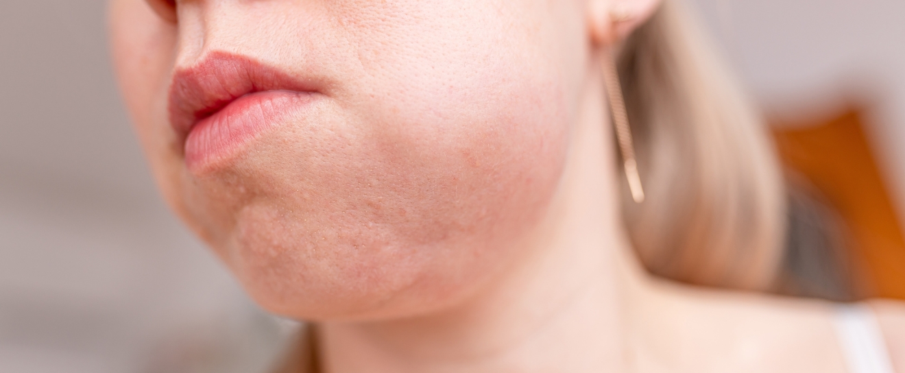 Dentist or Emergency Room? Where to Go for Facial Swelling and Dental Infection in Coralville
